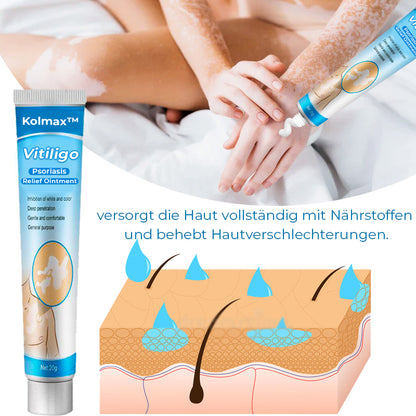 Kolmax™ Vitiligo Linderungssalbe